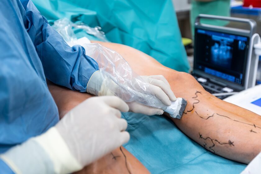 A Comprehensive Guide to Laser Ablation Therapy